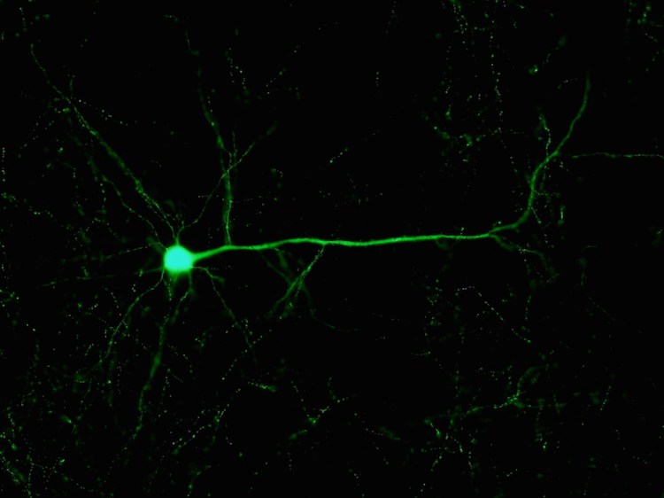 Bergstrom_neuron