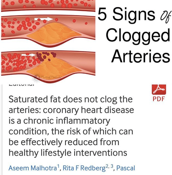 Screen Shot 2018-03-20 at 2.05.35 PM