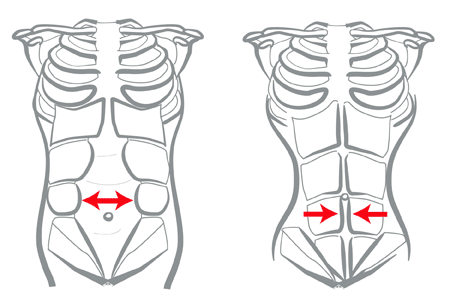 diastasis-drawing.gif