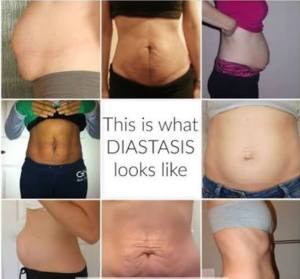 36878486_1992993184345294_2998381927070695424_n