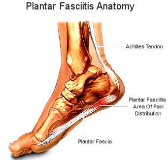 83f58-plantar-fascia